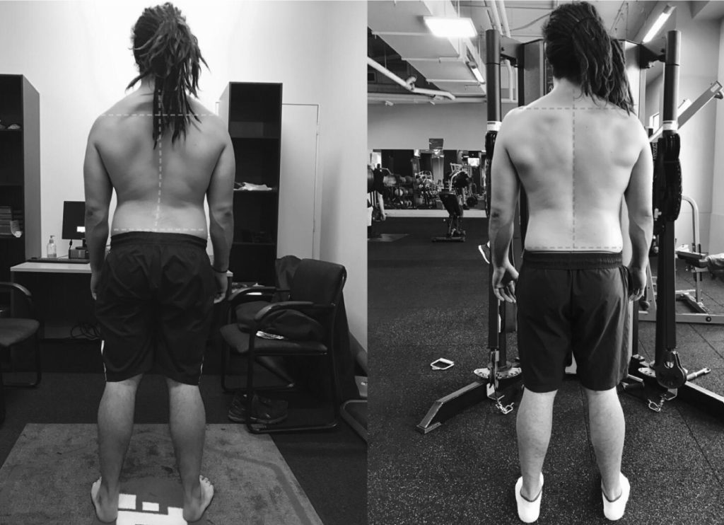 Functional Training Melbourne | Functional Movement & Posture Alignment Training