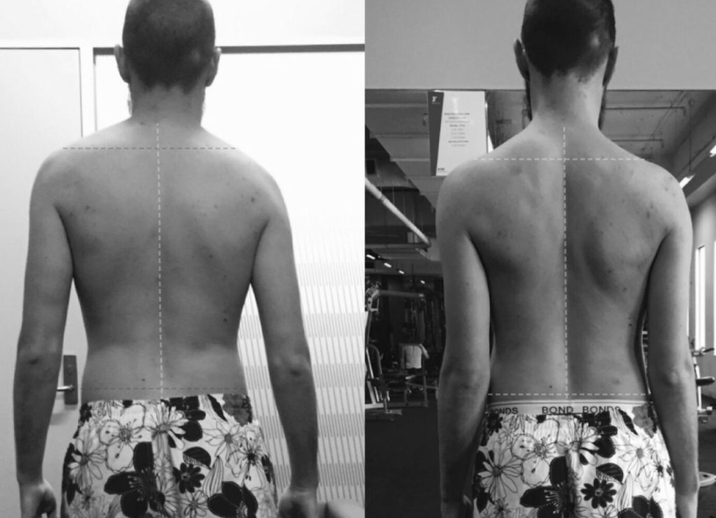Functional Training Melbourne | Functional Movement & Posture Alignment Training