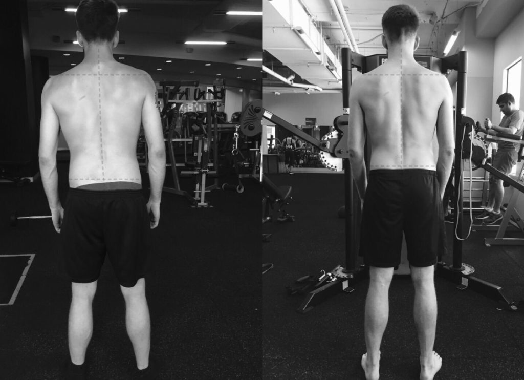Functional Training Melbourne | Functional Movement & Posture Alignment Training