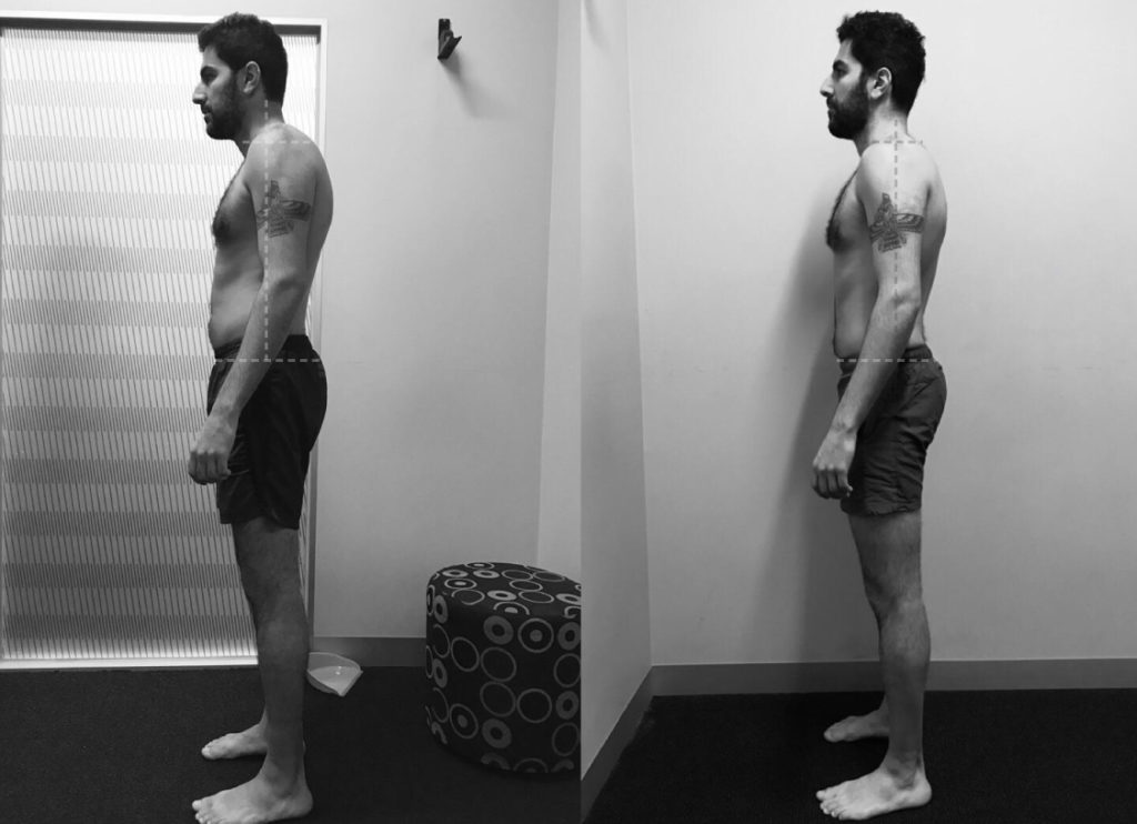 Functional Training Melbourne | Functional Movement & Posture Alignment Training
