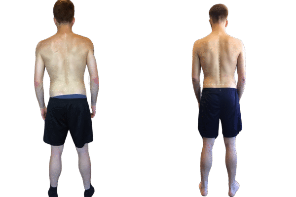 Functional Training Melbourne | Functional Movement & Posture Alignment Training
