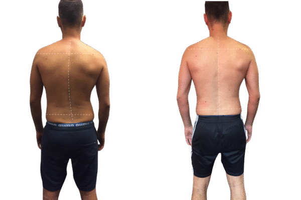 Functional Training Melbourne | Functional Movement & Posture Alignment Training