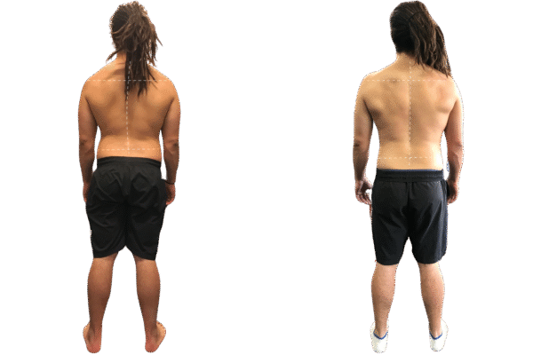Functional Training Melbourne | Functional Movement & Posture Alignment Training