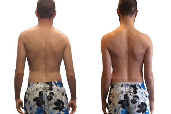Functional Training Melbourne | Functional Movement & Posture Alignment Training